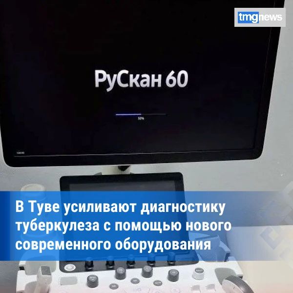 В Республиканском противотуберкулезном диспансере установили новый ультразвуковой аппарат «РуСкан 60»